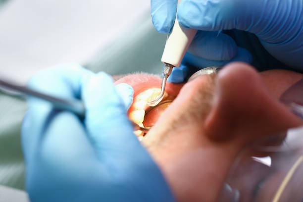 Best Emergency Dentist for Knocked-Out Tooth in West Haven, CT