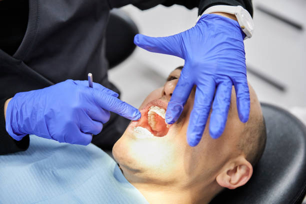 Best Emergency Dental Extractions in West Haven, CT